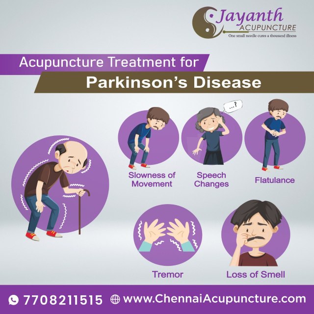 The Best Acupuncture Treatment in Chennai | Acupuncturist Near You | DoctorBest Acupuncture Treatment by Well Experienced Acupuncture Doctor in Chennai | Jayanth Acupuncture Clinic | Certified Zhu's Scalp Acupuncturist | IVF IUI Support Fertility Acupuncture