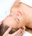 Acupuncturist in Chennai for Best treatment | Acupuncture Near Me