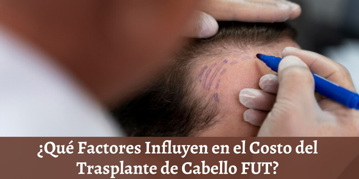 ¿Qué Factores Influyen en el Costo del Trasplante de Cabello FUT?